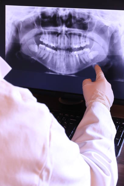 Best Broken or Cracked Tooth Emergency Dentist in Peru, IL